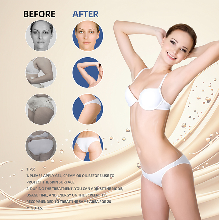 6in1 Desktop 40K Cavitation Machine High Frequency Slimming Skin Tightening Body Cavitation Machine Other Home Beauty Equipment