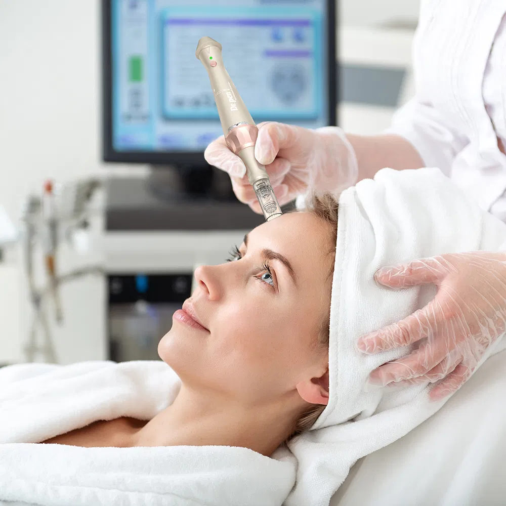 E30 Microneedling Device for Enhanced Skin Care and Acne Treatment