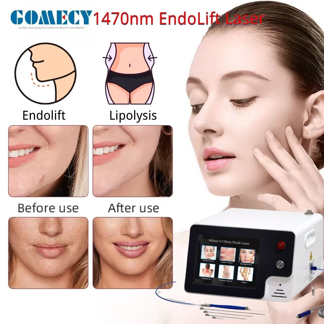 980nm Lipolysis 1470nm Endolift Laser Evlt Lipolysis Double Chin Body Beauty Equipment
