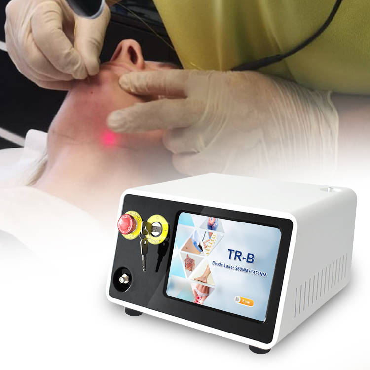 2026 Factory Price 47W Endolifting Surgery 980nm 1470nm Endo Facial Lifting Device