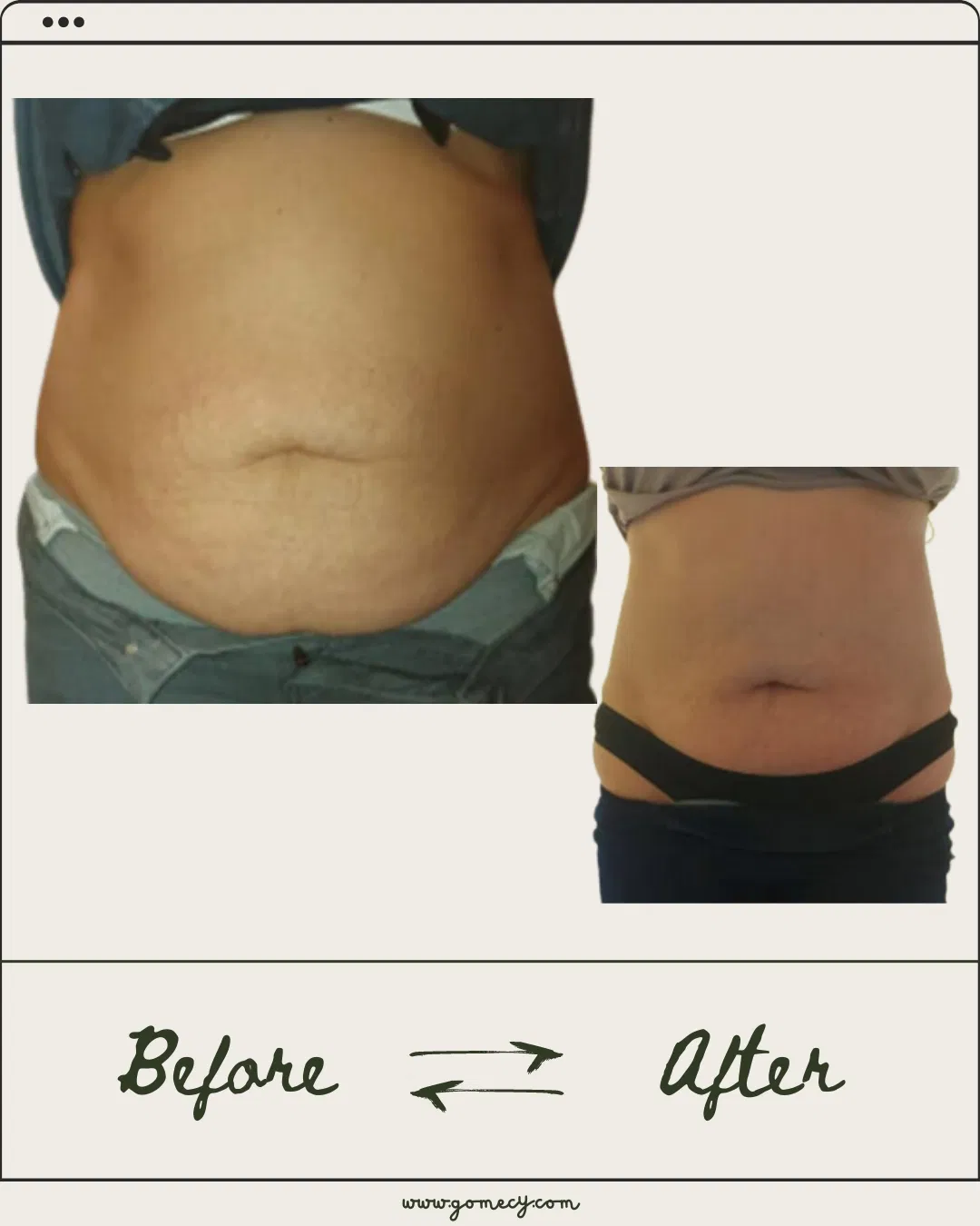 Home Use Fat Remove Body Slimming Skin Tightening Machine for Home SPA Salon Use Machine