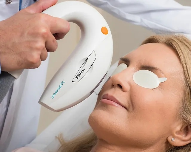 Professional IPL M22 Skin Care System Device with Anti Aging and Deep Pore Cleansing Tattoo Removal