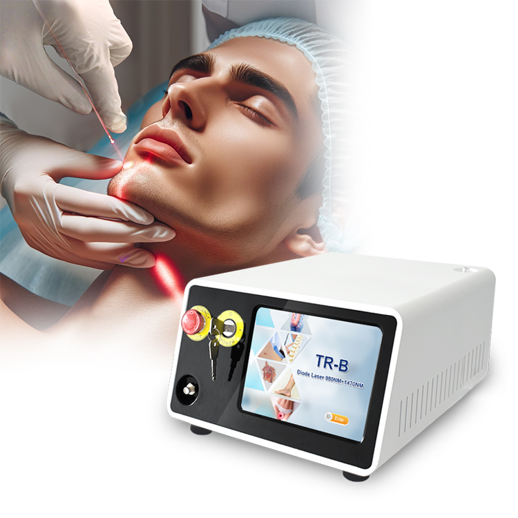 2026 Factory Price 47W Endolifting Surgery 980nm 1470nm Endo Facial Lifting Device