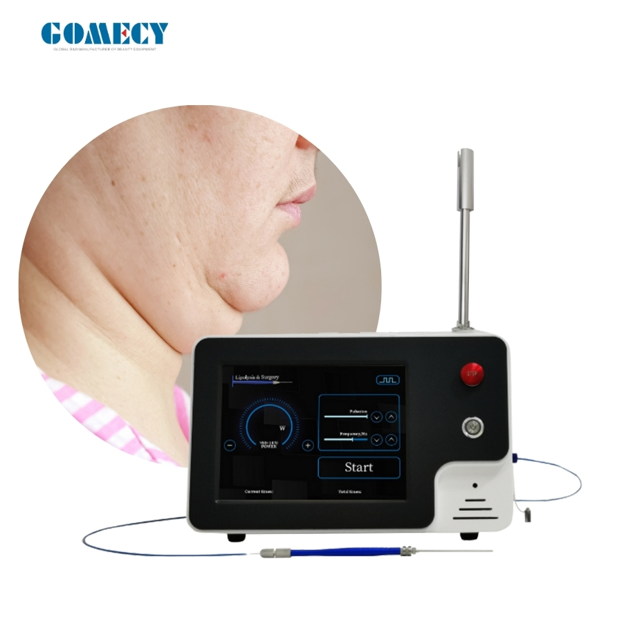 Double Chin Shaping 1470nm Endolift Laser Evlt Lipolysis Liposuction Vascular Remove