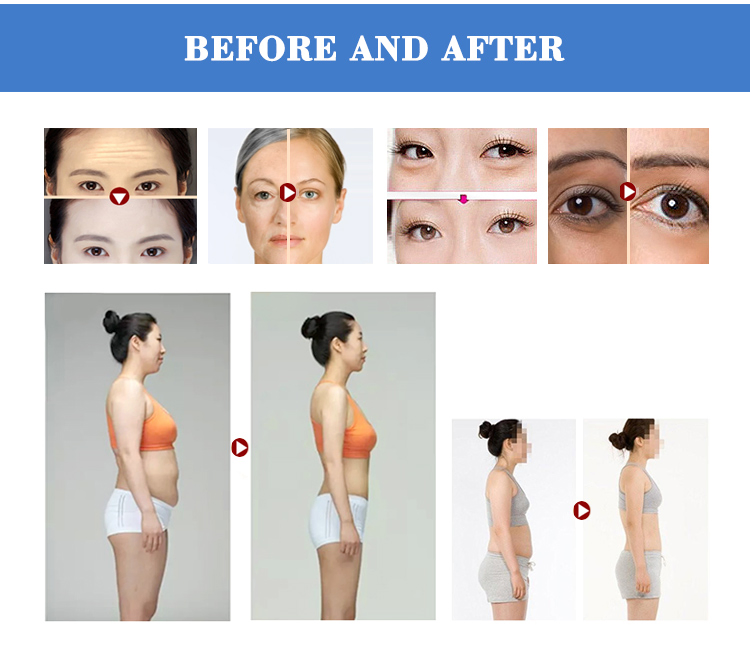 Portable RF Machine 2 in 1 for Skin Tightening Body Slimming Home Use