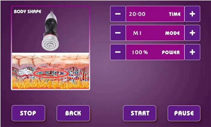 RF Ice Hammer Cooling Pore Shrink Wrinkle Removal Beauty Face Lifting Machine for Mini Skin Tightening Radio Frequency Home Use Rejuvenation Electric Facial