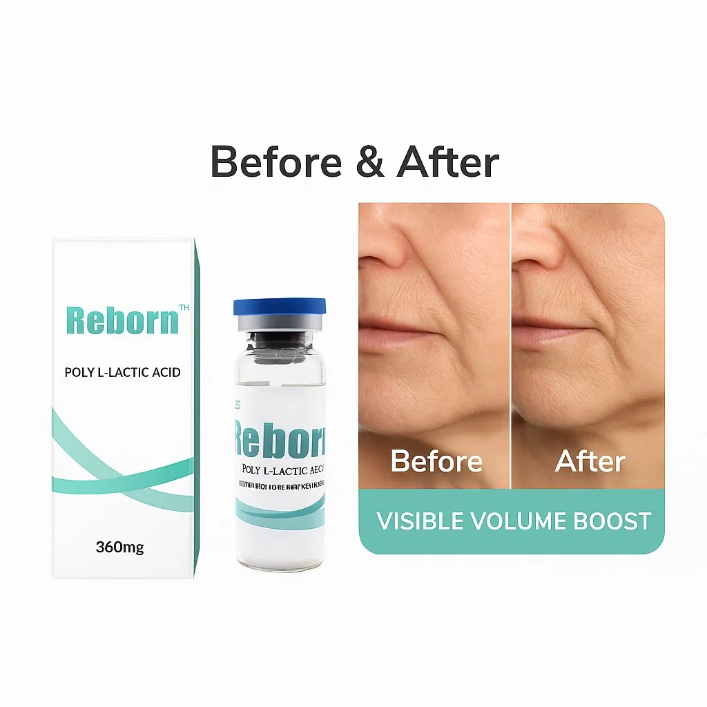Biodegradable Injectable for Face and Body Contouring Reborn Plla Dermal Filler 360mg 800mg