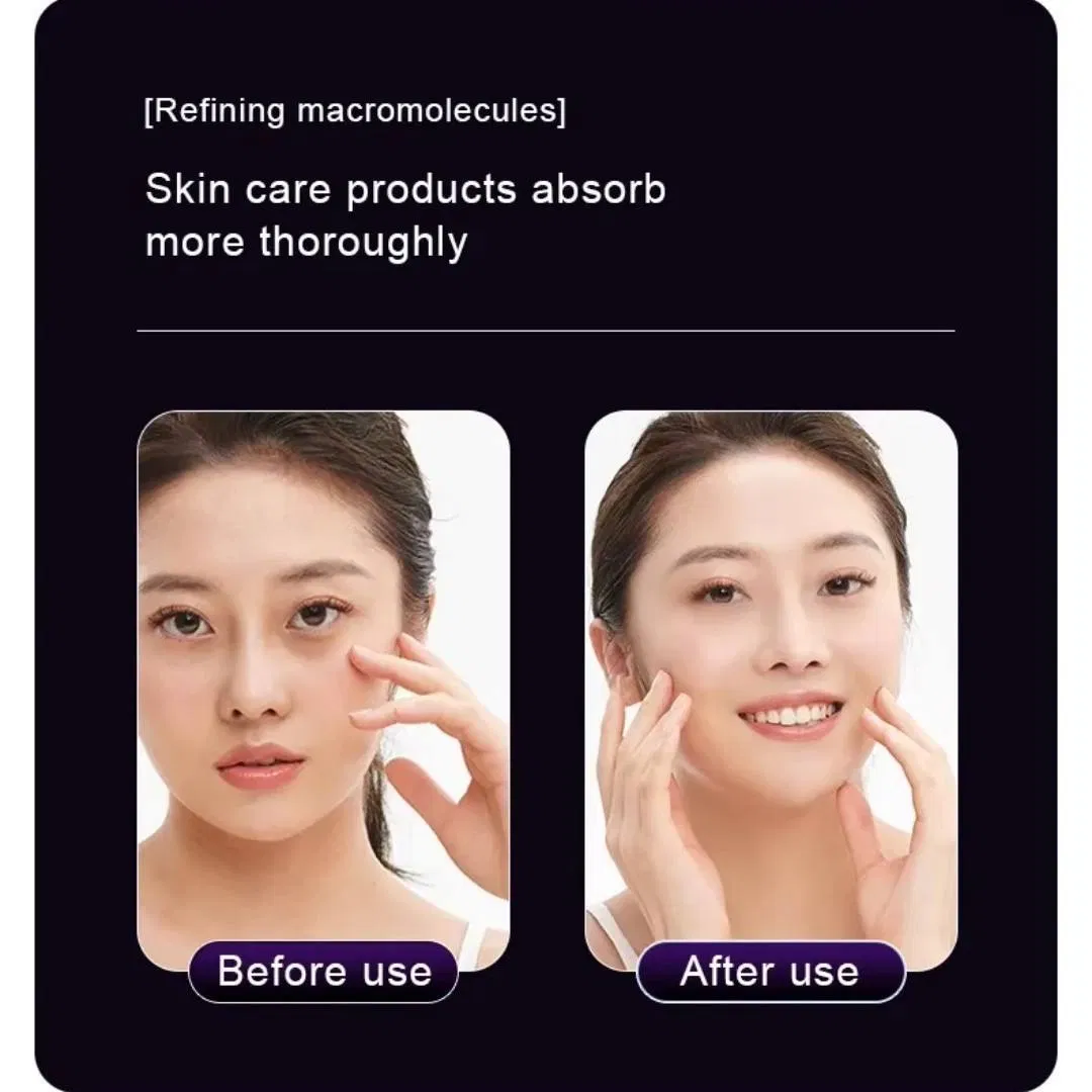 Multi Function RF Skin Lifting and Eye Care Face Beaty Machine