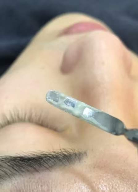 Home Vibrating Deep Cleansing Tools Skin Spatula Pore Cleaner Acne Treatment Blackhead Remover