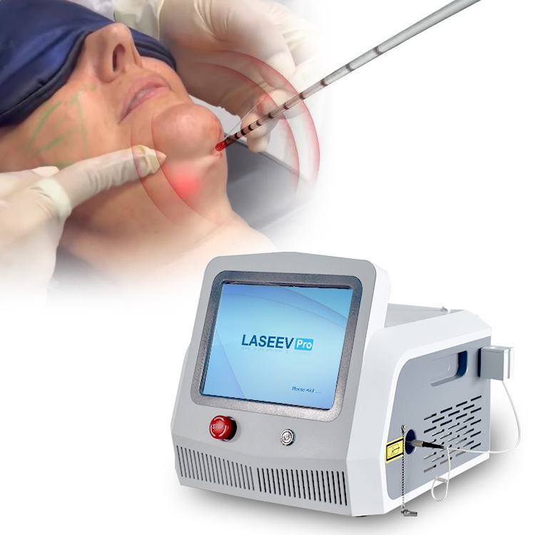 Endolaser 980nm/1470nm Liposuction /Lipolisis Body Shaping/Facial Lifting Firming Medical Device