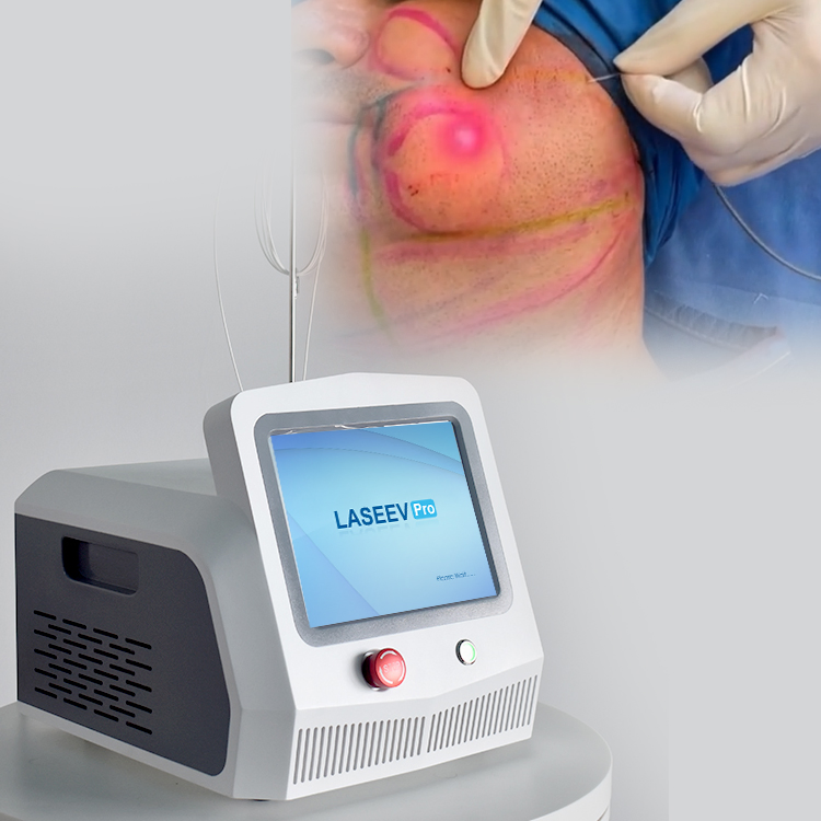 Endolaser 980nm/1470nm Liposuction /Lipolisis Body Shaping/Facial Lifting Firming Medical Device