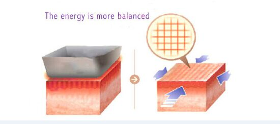 Fractional Radiofrecuencia Facial RF Face Lifting Skin Rejuvenation Home Use Machine