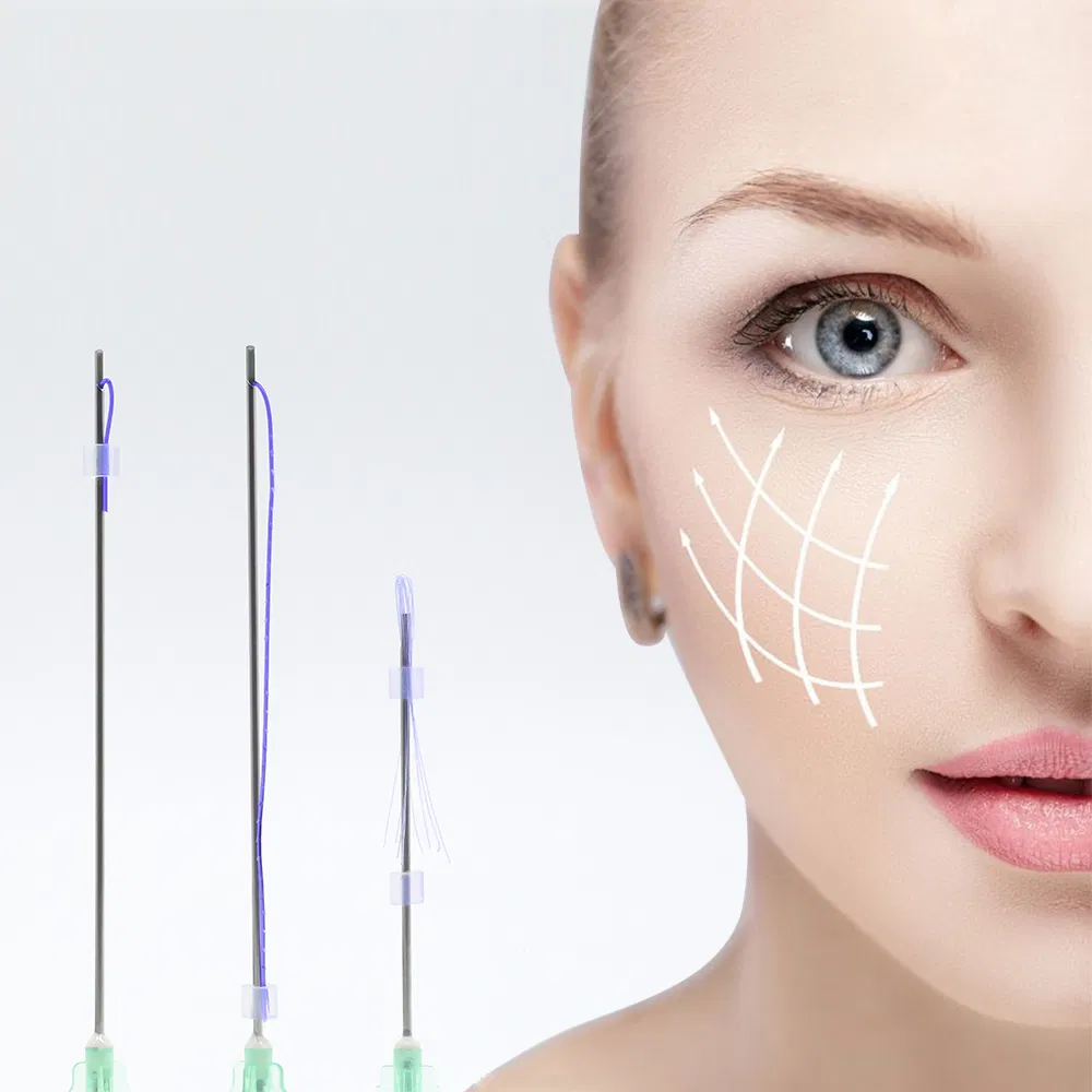 Pdo Lifting Thread Treatment