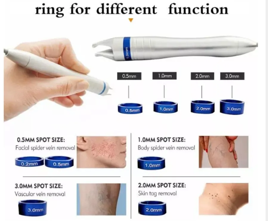 980nm Laser Principle