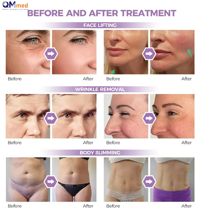 Before and After Treatment