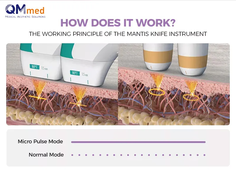 Skin Treatment Visualization