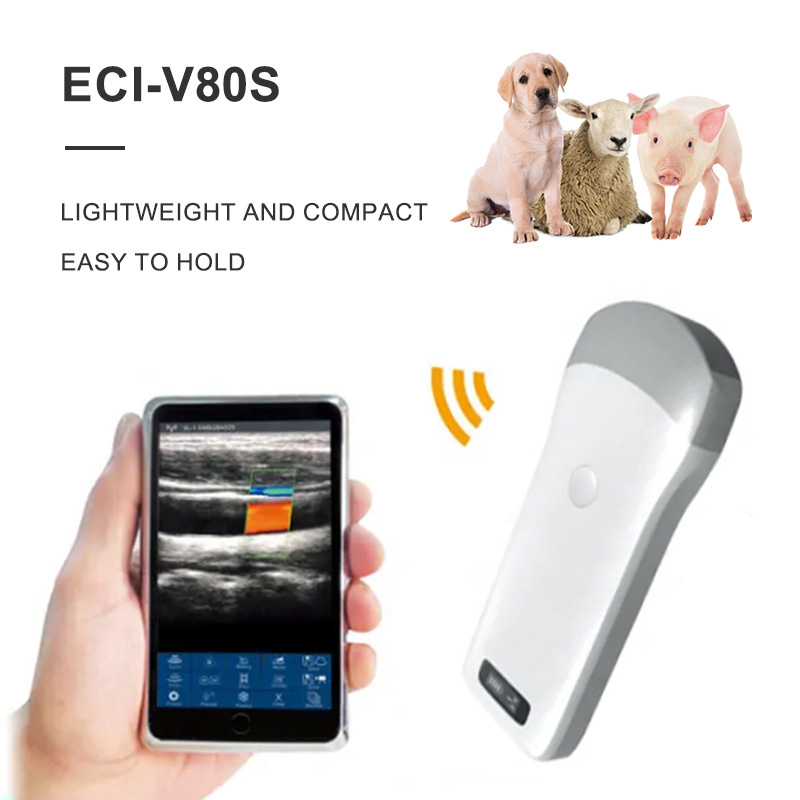 Wireless Ultrasound Scanner Overview