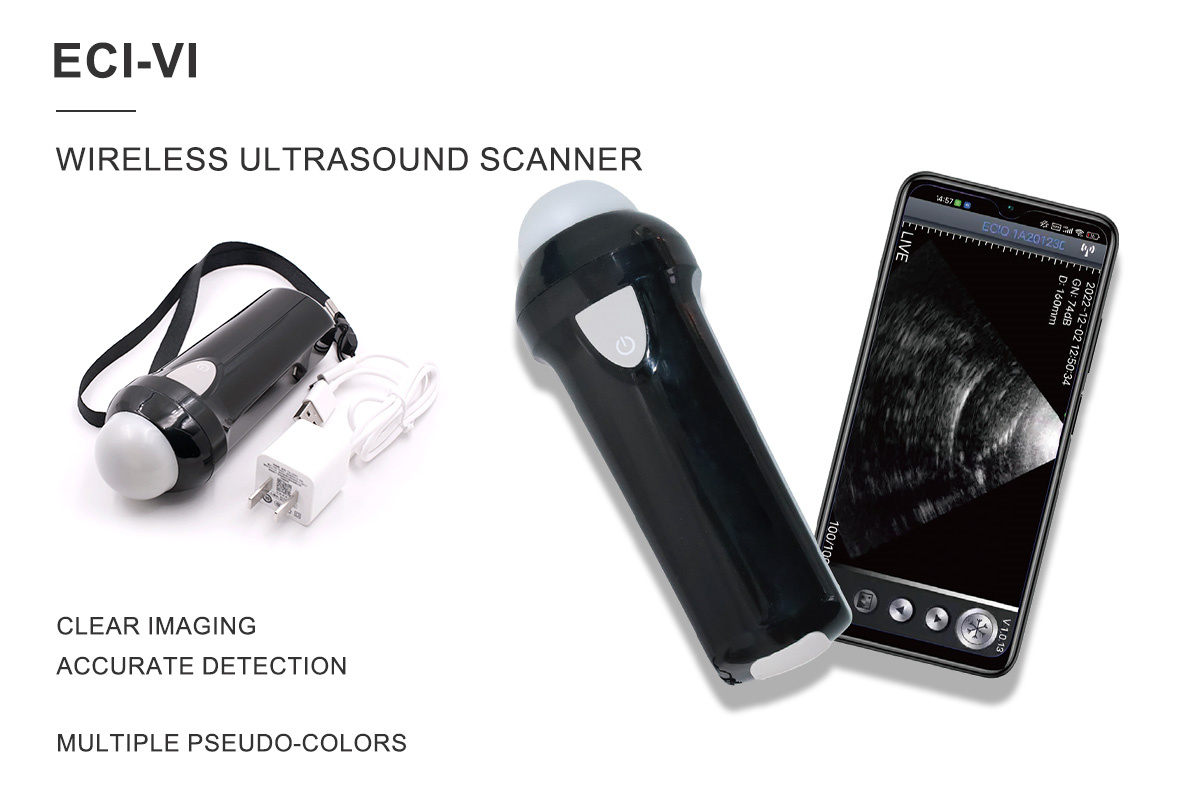 Wireless Ultrasound Scanner