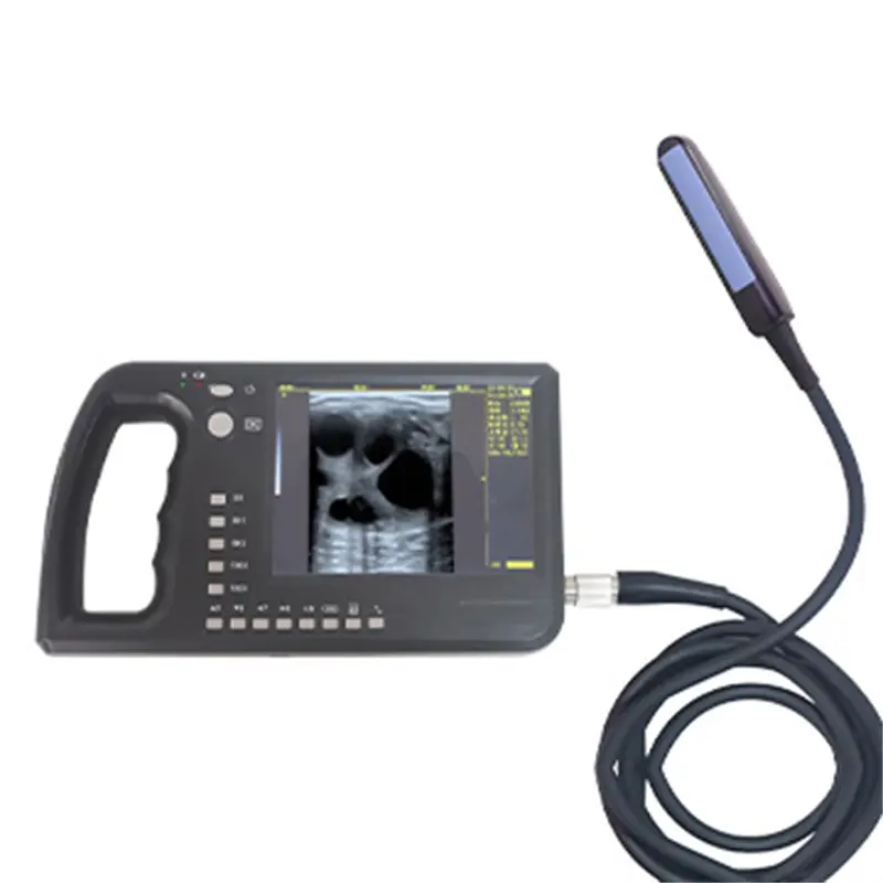 Wholesale ECI-3000A Eye Muscle Area Ultrasound Imaging Machine Suppliers, Exporter