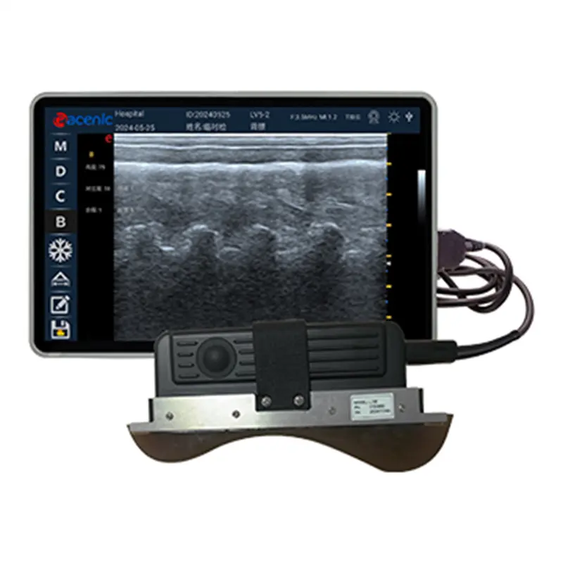 ODM ECI-X8M Color Doppler Veterinary Ultrasound Machine with Multiple Probes Manufacturers, Supplier