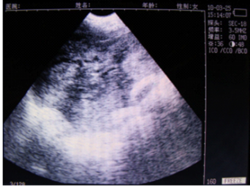 Non-pregnant