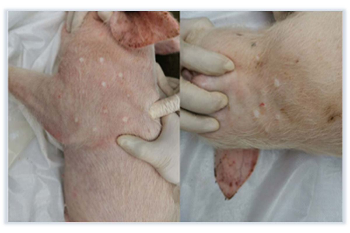 Needle-free injector advantage 1