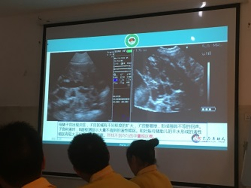 Inflammation