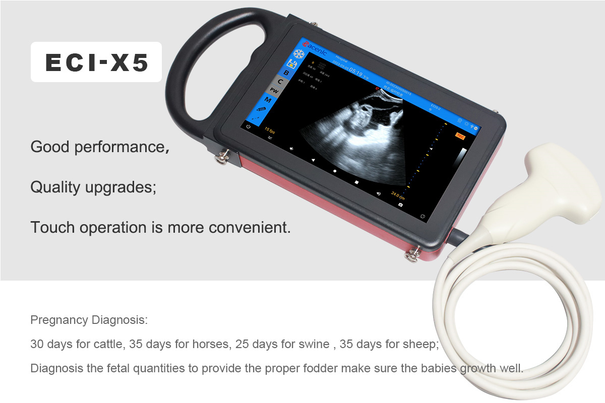 Ultrasound Imaging