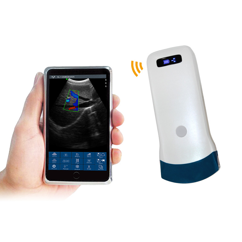 Ultrasound Detail 1