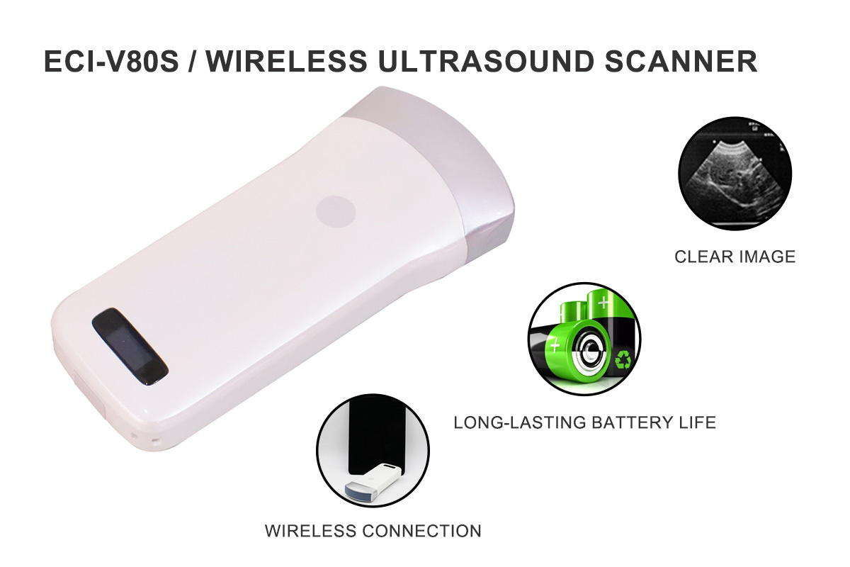 Wireless Scanner Advantage