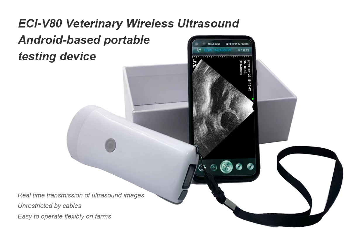 Wireless Ultrasound Scanner Description