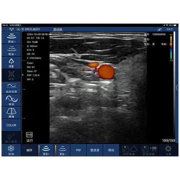 ODM CW-3CL Hand-held Wireless Doppler Ultrasound Scanner Manufacturer, Supplier