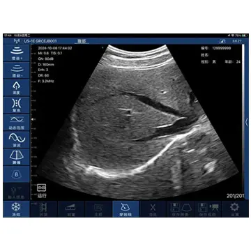 ODM CW-3CL Hand-held Wireless Doppler Ultrasound Scanner Manufacturer, Supplier
