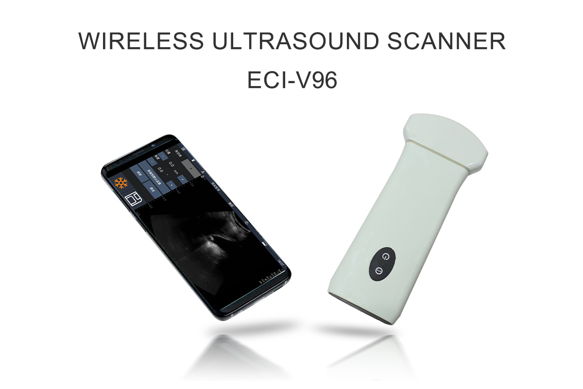 ECI-V96 Wireless Ultrasound Scanner Detail