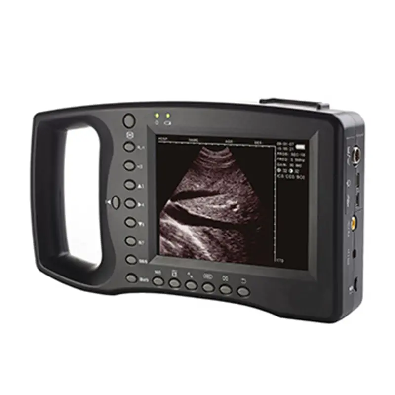 Wholesale ECI-3000D Ultrasound Machine for Loin-eye Muscle Testing Suppliers, Exporter