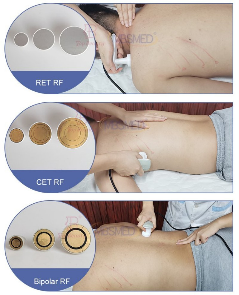 448kHz 6-in-1 Tecar Therapy Ret/Cer EMS Indiba Tecarterapia for Pain Relief Muscle Recovery