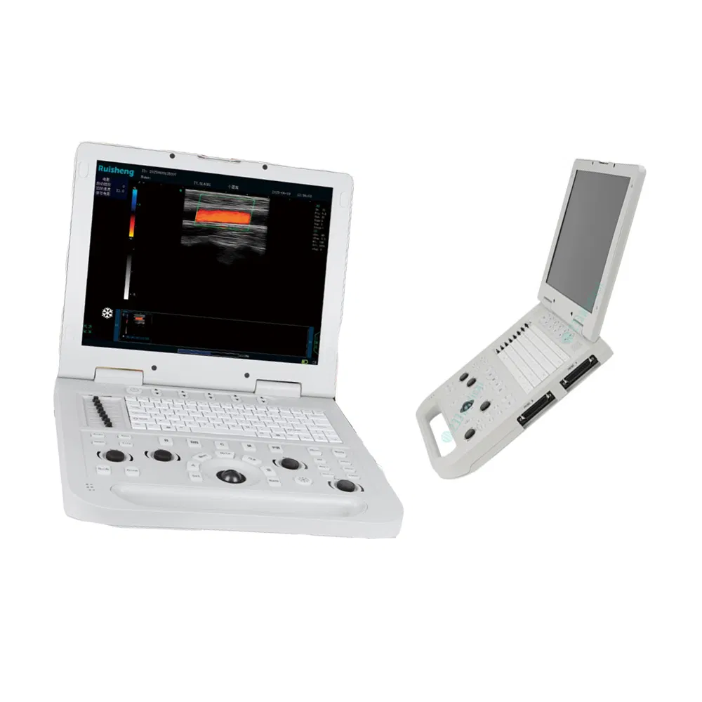 Full Digital Medical Ultrasound Diagnostic System Ultrasound Machine for Human Pregnancy