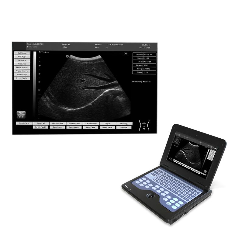 Medical Device Scanner Machine Handheld Ultrasound Diagnostic System