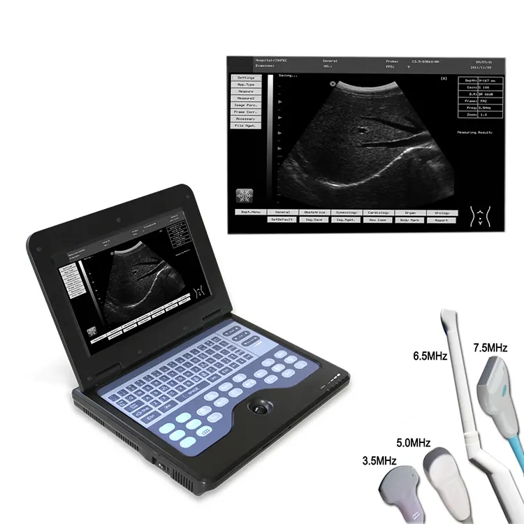 Medco Good Quality Medical Device Scanner Machine Handheld Ultrasound Diagnostic System