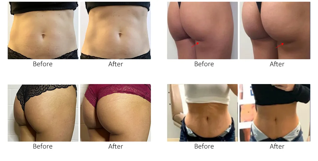 Muscle Increase Data