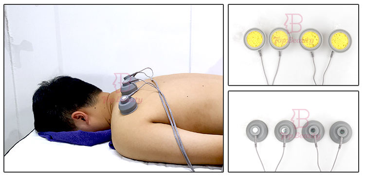 EMS Shock Wave Ondas De Choque Focales Shockwave Therapy Machine for Physical Therapy Rehabilitation Equipment