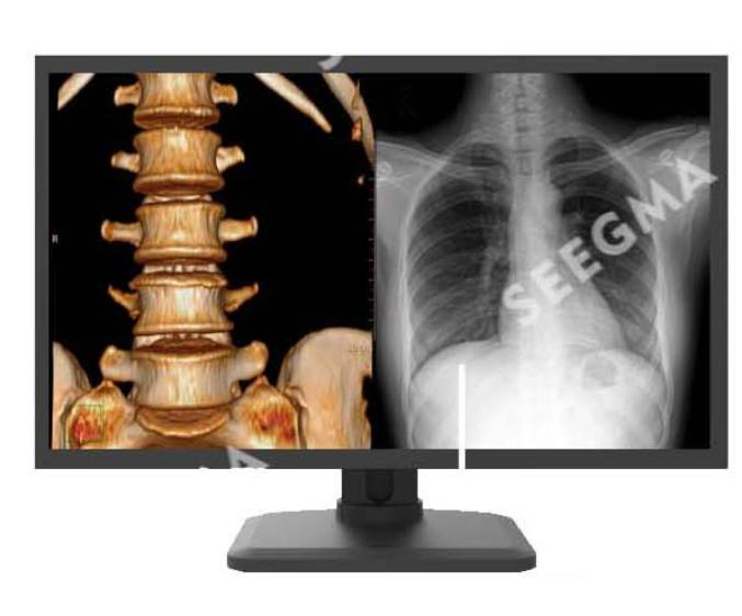 Medical Equipment MRI Compatible Sterilizer Ozone Double Disinfection System