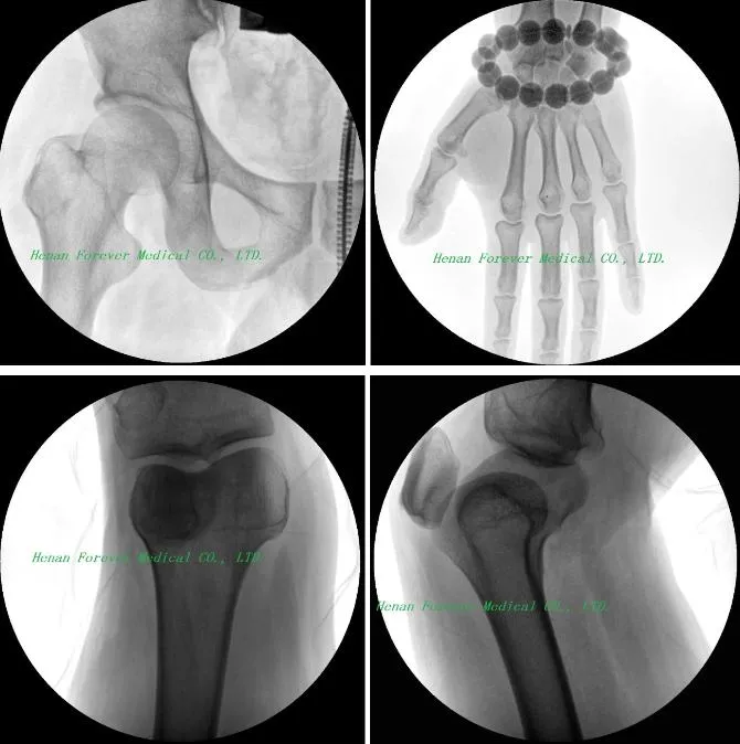 Detailed Image of C-Arm System