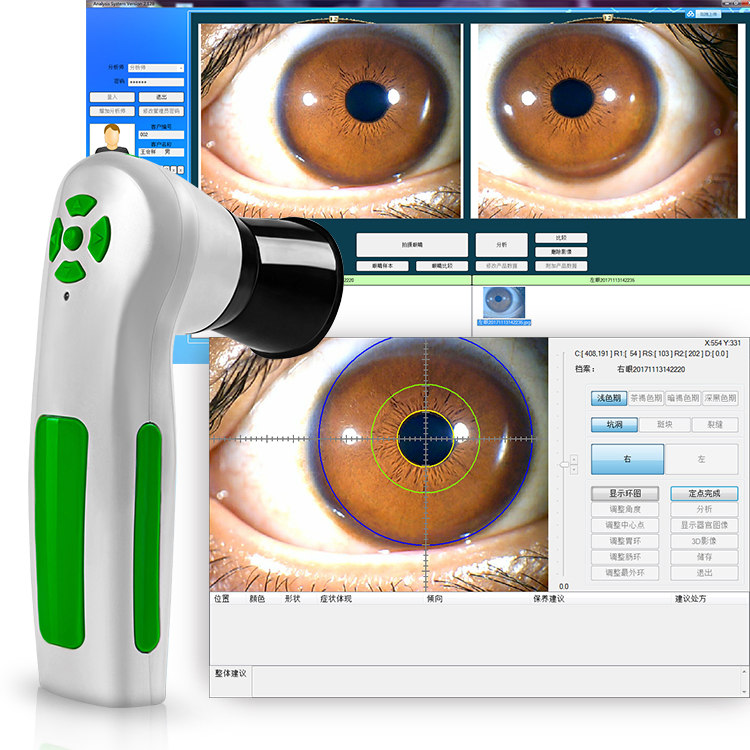 Home Use 12.0 MP USB Iris Analysis System Iridology Iriscope