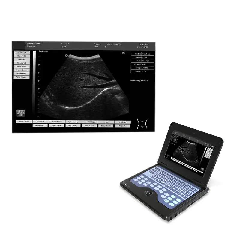 Medco Good Quality Medical Device Scanner Machine Handheld Ultrasound Diagnostic System