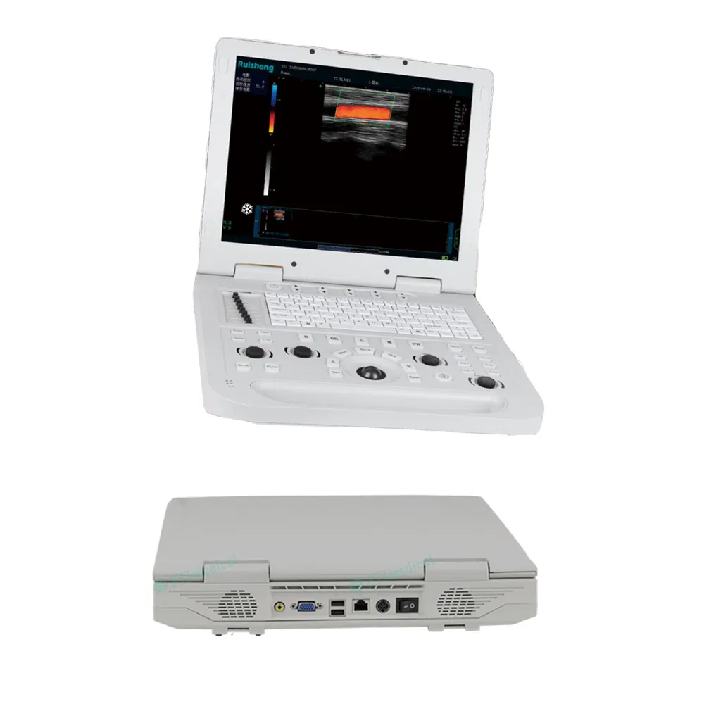 Full Digital Ultrasonic Diagnostic Imaging System B/W Portable Ultrasound Scanner Machine Ultrasound Machine for Hospital