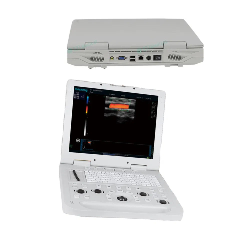 Hospital Medical Full Digital Portable Ultrasound System Machine Diagnostic Ultrasound Scanner Ultrasound Machine
