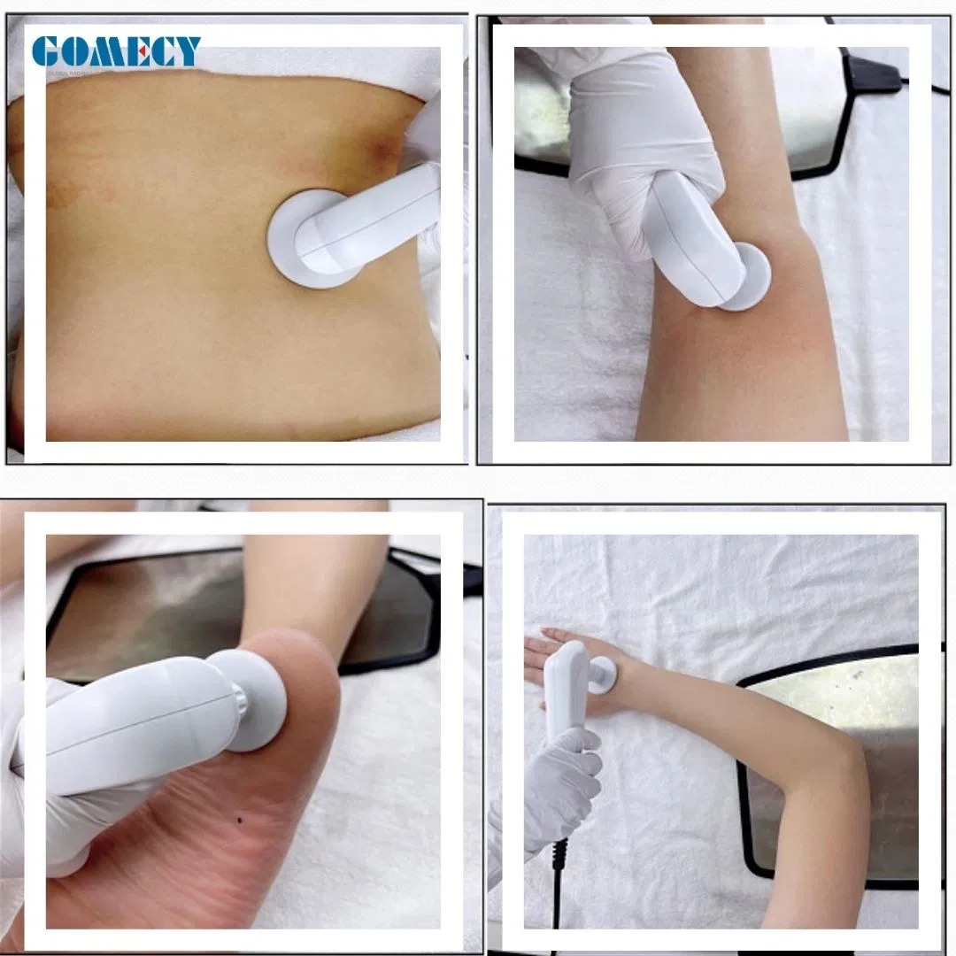 Tecar RF EMS 448kHz Pain Relief Portable Physical Therapy for Physiotherapy and ED Treatment