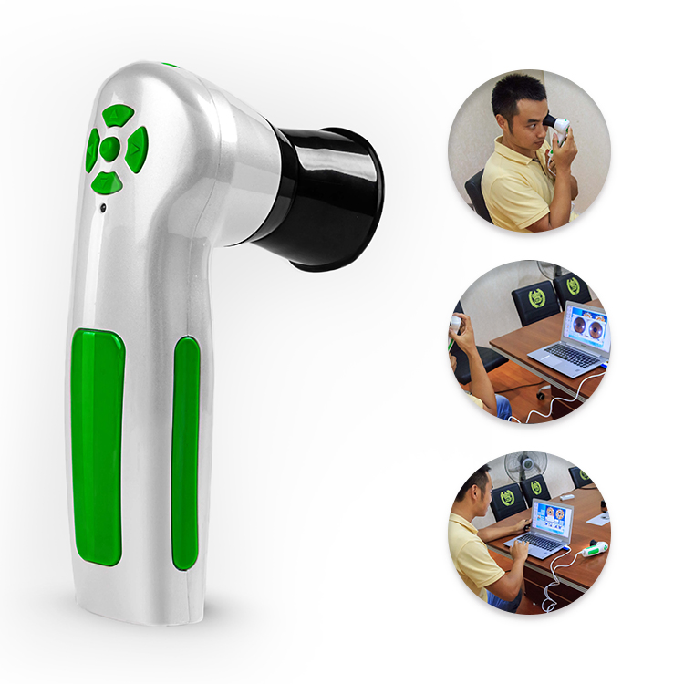 Home Use 12.0 MP USB Iris Analysis System Iridology Iriscope