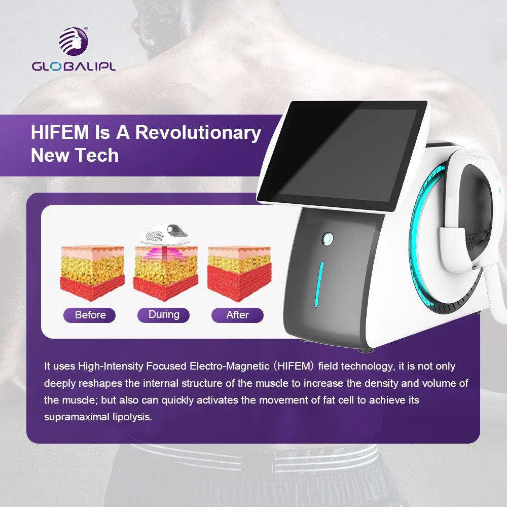 New Technology Body Sculpting Muscle EMS Abdominal Muscle Stimulator EMS Muscle Building